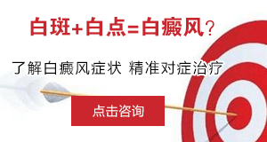 白癜风症状的特点