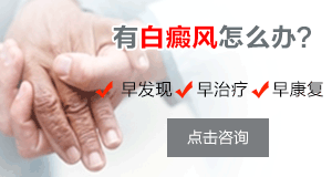 女性患者怎样治疗可以治愈白癜风