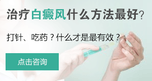 儿童白癜风如何治疗